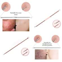 4 Pieces Professional Acne & Blackhead Remover Tool Kit - Includes Blackhead Extractor, Pimple Needle, Comprehensive Facial Cleansing Tool (Rose Gold 4 Pieces Set)