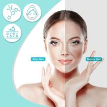 Adjustable Microneedle Roller: Professional Hair, Beard & Skin Care Tool - 140/100 Titanium Needles, Effective Results - Simple & Efficient Skincare Solution, Grooved/Round, Random Delivery. Minoxidil, Microneedle Roller, Microneedling, Beauty, Skincare, Spa, Self-Care, Skincare Tools, Facial Care, Esthetician Supplies, Massage, Facial Massage Tool, Facial Roller - White - View 4