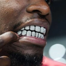 2pcs/Set Teeth Set Men Women Hip Hop Teeth Grills Iced Out Punk Men Women Teeth Decoration