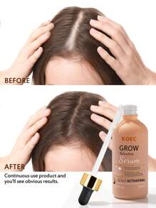 50毫升 KOEC 头皮滋养精华，焕活平衡头皮，增强发质，提升发量，滋养丰盈秀发，适合日常护发 - 西瓜粉 - 查看 5
