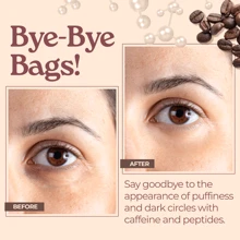 Caffeine Eye Cream -  Hydrating & Firming Under Eye Cream For Dark Circles, Eye Roller For Puffy Eyes, Reduces The Look Of Puffiness And Bags, Coffee Eye Cream W/ Hyaluronic Acid, Peptides Summer - Multicolor - View 3