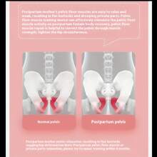 Intelligent Pelvic Floor Muscle Trainer, Effective Leg Exercise, Improved Bladder Control, Postpartum Recovery Kegel Pelvic Hip And Leg Clamp Equipment, Used For Postpartum Recovery And Leg Fitness - Pink - View 5