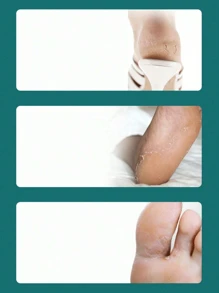 1-4 dụng cụ loại bỏ vết chai ở chân, dụng cụ cạo tẩy tế bào chết, dụng cụ chăm sóc móng chân, loại bỏ da chết cho gót chân, sản phẩm chăm sóc bàn chân, dụng cụ tẩy tế bào chết cho gia đình, cho vết chai da chết, cho da khô, nứt nẻ, cứng cho nam nữ, dụng cụ chăm sóc bàn chân để sử dụng hàng ngày tại nhà, túi xách, hộp đựng, đồ lưu trữ - Nhiều màu - Xem 4