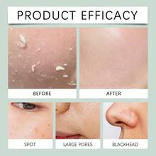 洗面奶、洁面霜、去角质磨砂膏、草本洁面凝胶、温和护肤、亮白、收缩毛孔、适用于堵塞毛孔和黑头 - 薄荷綠 - 查看 9