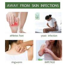 Xà phòng tinh dầu bạc hà GZE Xà phòng rửa mặt & cơ thể Thanh làm sạch sâu lỗ chân lông Cạo râu Tẩy tế bào chết Kiểm soát dầu thủ công Dưỡng ẩm cho mặt Sữa tắm dưỡng ẩm Bọt phong phú Dầu gội đầu làm mới bạc hà khi đi du lịch - màu xanh lá - Xem 7
