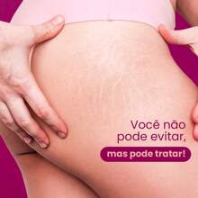 Rosativ Anti-Stretch Mark Moisturizing Deodorant Body Cream 180ml Queen Bee REF 3095