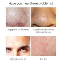 2% AHA BHA 精华，肌肤焕然一新的秘密武器！含有 2% 果酸 (AHA) 和水杨酸 (BHA)，协同双酸配方可温和去除角质、疏通毛孔。有效改善暗沉、粗糙，减少黑头和瑕疵。轻盈精华易于吸收，带来清爽舒适的感觉。持续使用可让肌肤更健康、更容光焕发。 - 杏色 - 查看 2