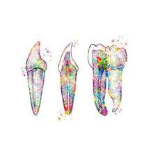 1 件牙种植体帆布壁画牙科艺术海报牙医解剖图医学壁画医院诊所装饰无框 - 多色 - 查看 11