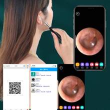Ear Cleaner With Camera Smart Earwax Remover Endoscope - Hồng - Xem 6