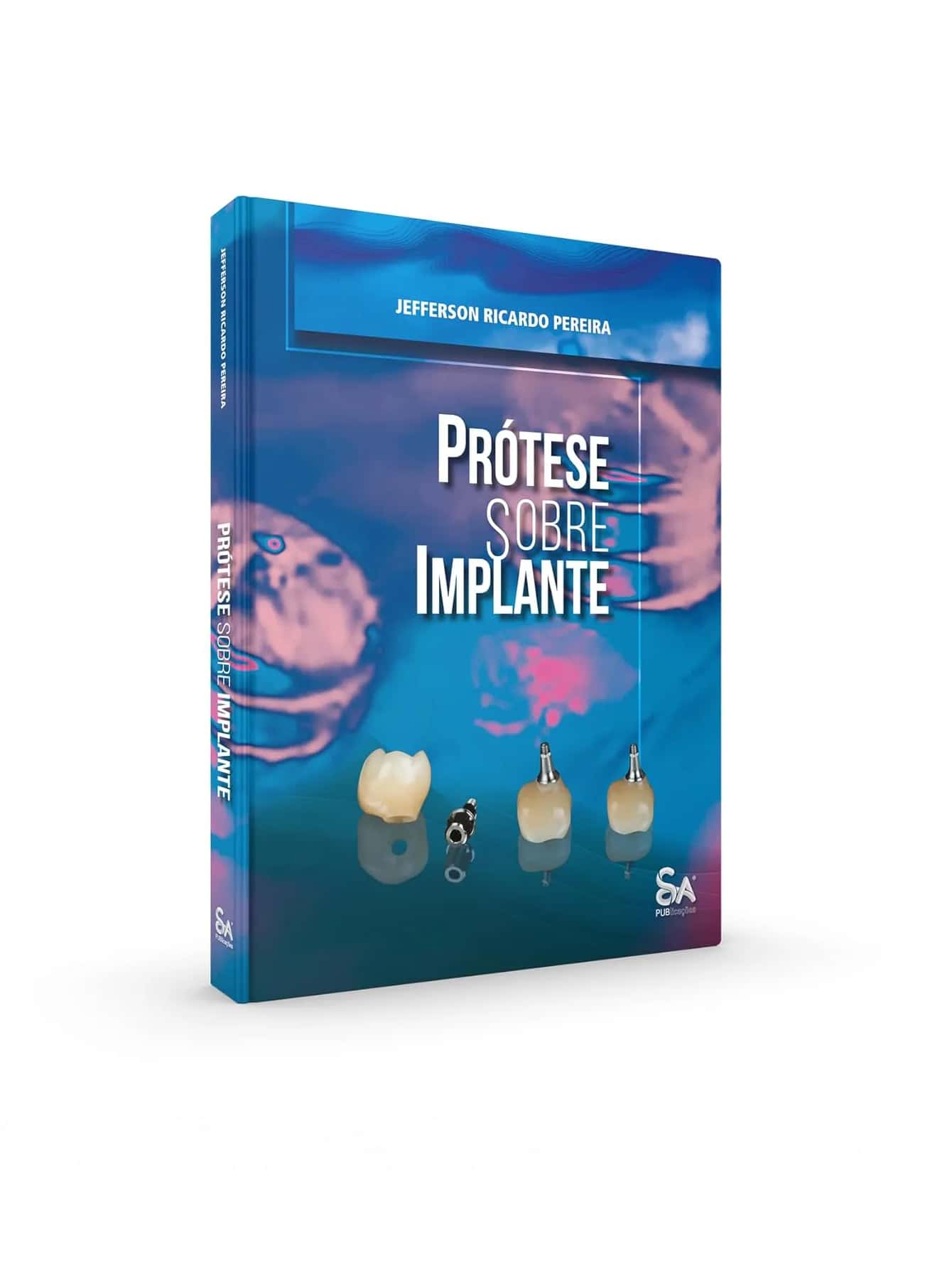 Prosthesis On Implants, 1st Edition 2024 - 2024 年初版 - 查看 1