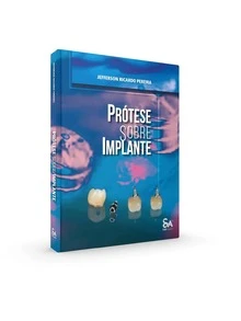 Prosthesis On Implants, 1st Edition 2024 - 2024 年初版 - 查看 2