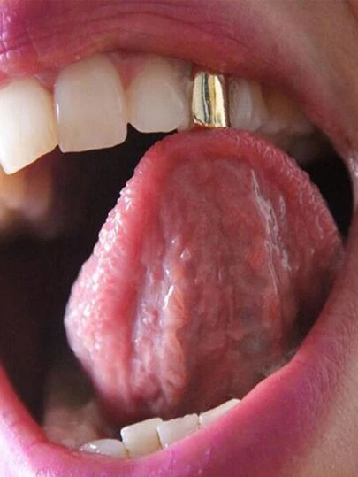 Moonfan 1pc Unisex Hip-Hop Style Tooth Grillz, Suitable For Daily Wear
