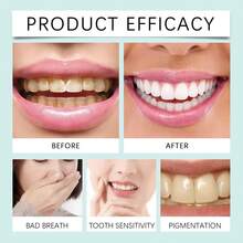 30 viên kem đánh răng dạng rắn nhiều hương vị, làm sạch và chăm sóc răng sâu, loại bỏ vết ố trên răng, viên chăm sóc răng di động - Nhiều màu - Xem 5