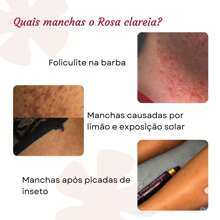 Wild Rose Activated Whitening Acid Lotion For Body Dark Spots Folliculitis Armpit Groin Intimate 100 Ml - 白色 - 查看 8