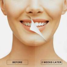 Fairywill Electric Toothbrush Heads 8pcs Replacement For Toothbrush Black - Black - View 4