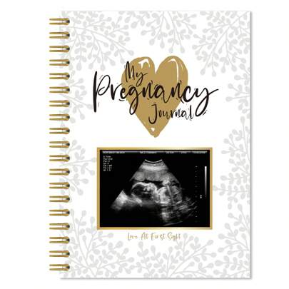 82 Sheets Pregnancy Journal, Pregnancy Book Memory Book For Expecting First Time Moms & Experienced Moms With Sonogram Photo Frame, Mom Book Diary For Gift, Pregnancy Album Commemoration, Baby Album, Pregnancy Journal Memory Book For First Time Moms 2025