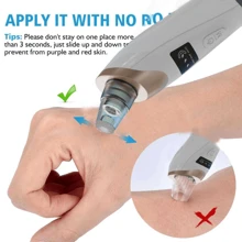 Extractor de puntos negros con succión - Masajeador facial de belleza recargable por USB, kit de limpiador de poros multifuncional, herramienta extractora de limpieza para adultos