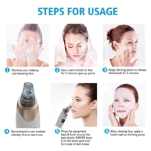Extractor de puntos negros con succión - Masajeador facial de belleza recargable por USB, kit de limpiador de poros multifuncional, herramienta extractora de limpieza para adultos