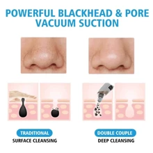 Extractor de puntos negros con succión - Masajeador facial de belleza recargable por USB, kit de limpiador de poros multifuncional, herramienta extractora de limpieza para adultos