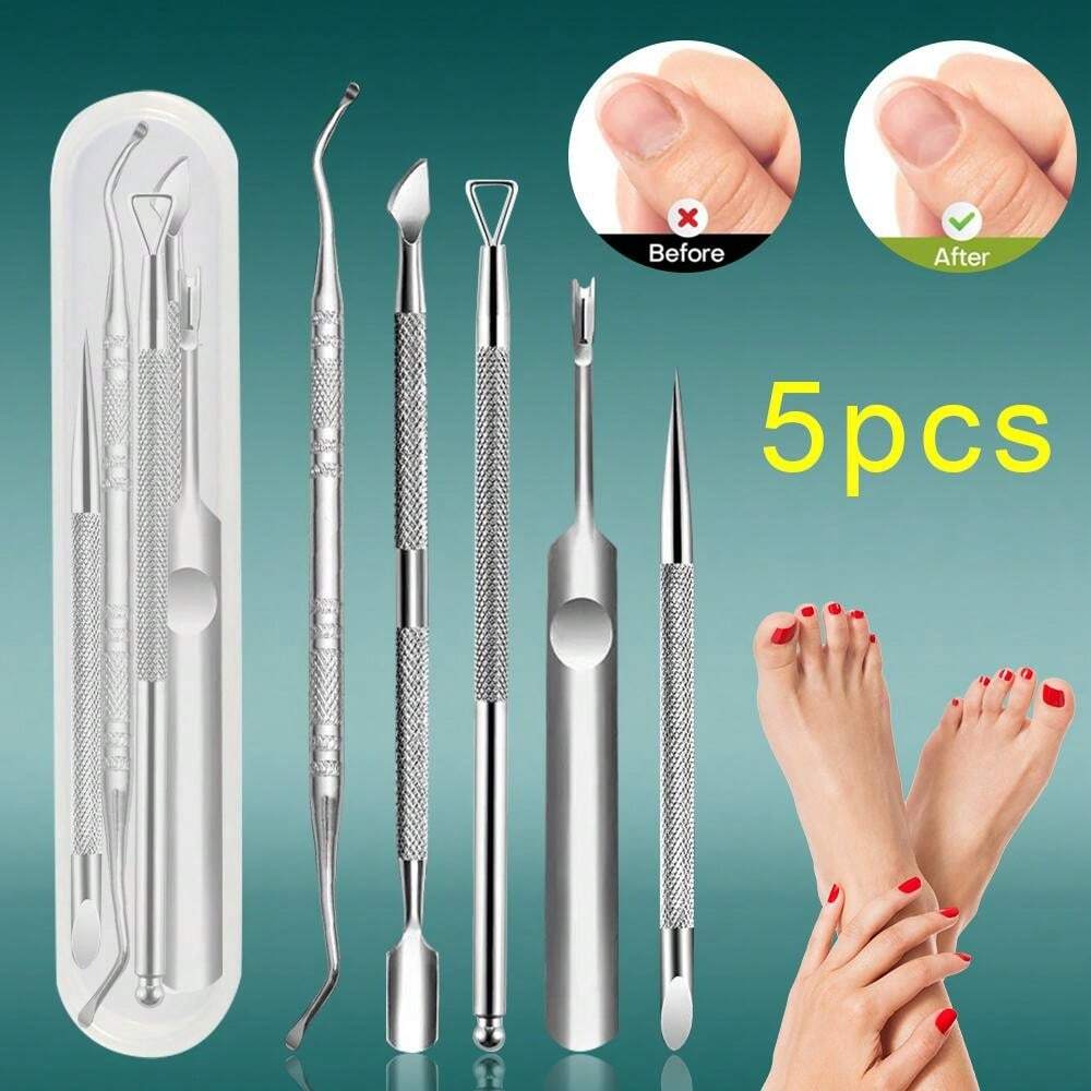 Angelrollen Reparatur Set Aus Edelstahl - Komplettes Werkzeug Set Für Rollen Wartung