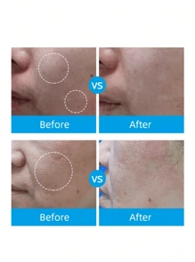 La Roche-Posay Skincare Set - B5 Multi-Hydrating Repair Face Mask + New B5 Multi-Soothing Repair Cream, Hydrating, Repairing And Calming For Sensitive Skin