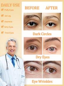 1/5/10/20/30/50 pièces Masque oculaire à vapeur jaune vitaminé, usage unique auto-chauffant, sans alcool, sans odeur, soulage la fatigue et la sécheresse oculaires, aide au sommeil quotidien, sieste de milieu de journée, détente en voyage, accroché à l'oreille, lunettes de voyage portable et d'affaires, fournissant des soins de base pour les yeux pour les utilisateurs d'ordinateurs et de téléphones portables, convenant aux étudiants et aux travailleurs de bureau