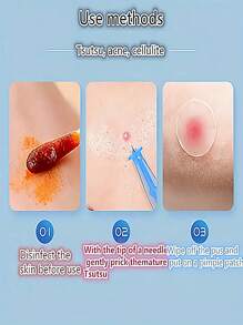 200/100/50/30/10 peças Ferramenta Descartável de Remoção de Cravos, Agulha Profissional para Espinhas, Ferramenta de Remoção de Acne, Higiênica, Adequada para Cuidados Faciais Pessoais e Uso em Salão (Formato de Cabeça Plana)
