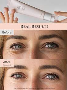 焕活眼部精华，含视黄酸烟酰胺，可消除浮肿眼袋、细纹、黑眼圈、皱纹，抗衰老，保湿，滋养，护肤 30ml/1fl.Oz. 韩国美容礼品