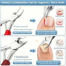 Bộ 5 kềm cắt móng tay - Lưỡi cong sắc bén chuyên nghiệp, bền chắc, thích hợp cho móng chân dày và mọc ngược - Lý tưởng cho nam giới và người cao tuổi, bao gồm dụng cụ làm sạch móng - nhiều màu - Xem 2
