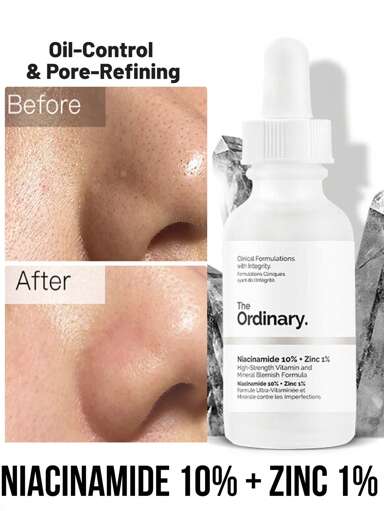 The Ordinary 烟酰胺 10% + 锌 1% 精华液，缩小毛孔，调节皮脂，淡化瑕疵，1 件 30 毫升 1.01 液体盎司，轻盈凝胶质地，易于吸收，无油配方，无香精，高强度维生素配方，维生素 B3 和锌复合物