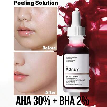 The Ordinary AHA 30% + BHA 2% 精华液，促进去角质，解决皮肤纹理不规则和暗沉肤色问题，焕发肌肤活力，1 件 30 毫升 1.01 液体盎司