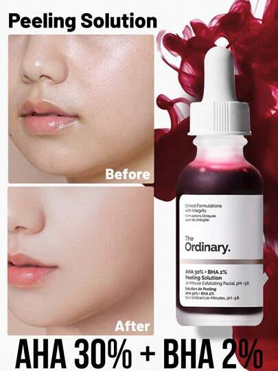 The Ordinary AHA 30% + BHA 2% Serum, Exfoliation Boost, Solve Textural Lrregularitie & Lackluster Tone Issue, Skin Rejuvenation, 1pc 30ml 1.01 Fl Oz