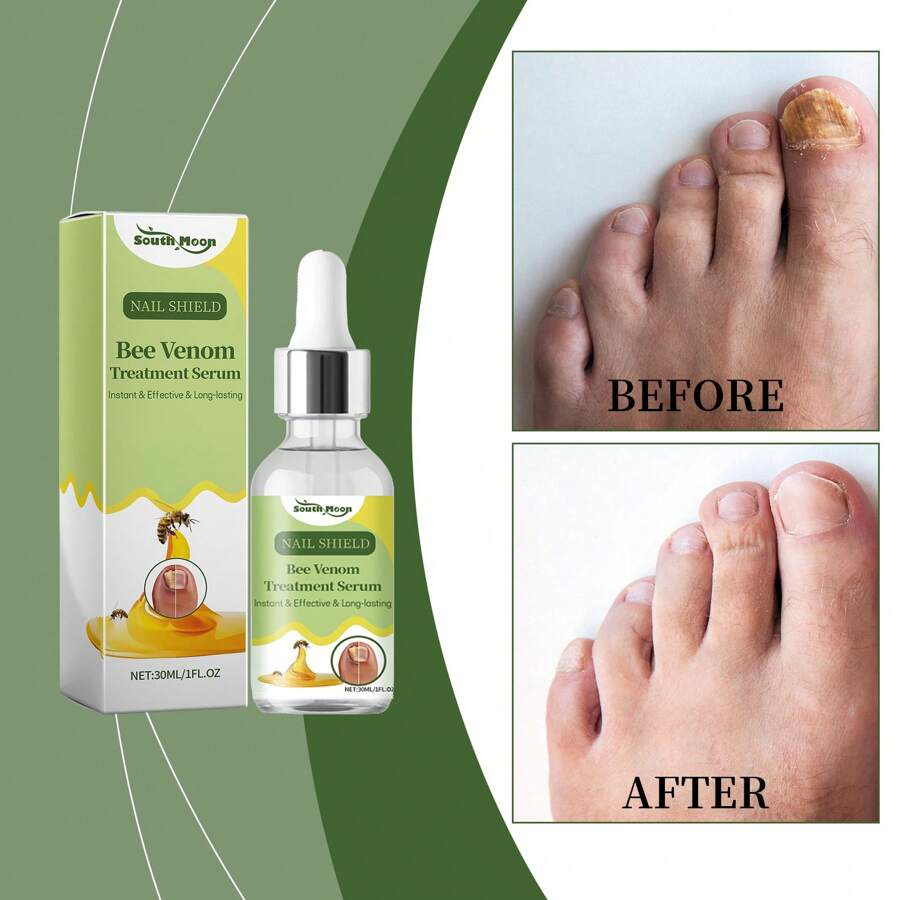 Nail Repair Serum Repairs Damaged, Discolored, Cracked Nails Restores
