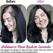 Human Straight Hair Toppers For Women Real Remy Hair Hair Toppers For Thinning Hair ,Hair Loss, Cover Bald Or White Hair Multicolor Color 12x13cm Silk Base Three Clips In Topper (10inch)1B# Natural Black - S1 - 查看 6