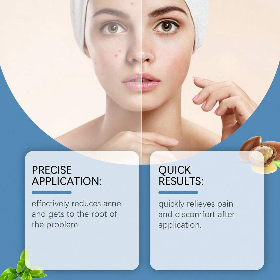 South Moon Acne Care Pen Gentle Cleansing Acne Blackheads Closed