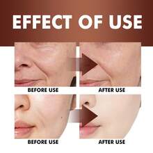 AM/PM 双重精华，含有视黄醇、烟酰胺精华 - 淡化细纹、提亮肤色、紧致保湿抗衰老精华，适合所有肤质 - 彩色 - 查看 3