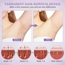 IPL Laser Hair Removal Device, Painless Permanent Hair Removal Throughout The Body, Freezing Point Hair Removal Device - Xem 3