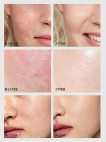 La Mer Serum dưỡng ẩm phục hồi dưỡng ẩm điều trị 5 Fl. Oz.Liq./150ml - Nước tinh chất 150ml - Xem 10