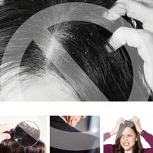 Premium Stainless Steel Comb - Effective Dandruff Remover, Lice Comb, Scalp Massager For Decompression, Gentle Cleaning, And Hair Detangling - Easy To Clean And Portable Design