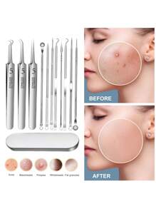 YUANDU Blackhead Removal Kit, Professional Stainless Steel Comedone Extractor Tool For Acne, Pimples, Blackhead Care