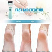 Foot File, Foot Scraper To Remove Calluses And Dead Skin, Foot Care Tools - Multicolor - View 4