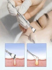 Set di 4 pezzi di strumenti in acciaio inossidabile per la rimozione dell'acne, kit estrattore di punti neri e brufoli con custodia, kit di strumenti di bellezza e trucco