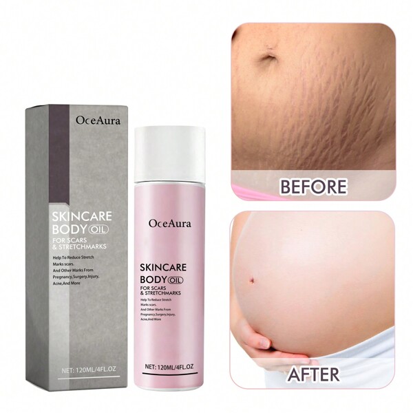 Skincare Body Oil, Fade Scars, Pregnancy Fine Lines, Moisturize And Repair Delicate And Smooth Body Skin