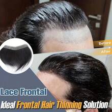 Toupee For Men Ultra-Thin Natural Hair - Invisible Seamless Frontal Hairline & Forehead Patch, Straight Hairpiece