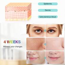 KINGSTEAM LED Facial Mask 7 Colors Therapy Face Neck - US A Type Plug(110-127V) - View 3