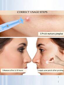 50/100pcs/Set Acne Needle Pimple Removal Disposable Tools,72/108 Dots Acne Pimple Stickers And Ultrafine Needle Set,For Pick Acne,Blackhead,Comedone Easily Removal