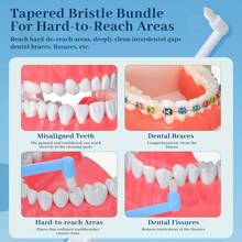 Push-Pull Orthodontic Care Imported Steel Wire Interdental Brush, Dental Retainer Soft Bristle Teeth Fissure Cleaner