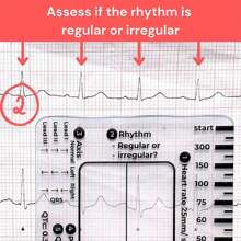 ECG 7 Step Ruler, ECG Ruler Plastic Ruler Measuring Tool, ECG 7 Step Ruler For ECG/EKG Interpretation, Transparent EKG Calipers Measuring Tool, Easy-To-Carry ECG Ruler, Follow A 7 Step Plan - Multicolor - View 6