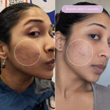 Milky Fade Serum - Multicolor - View 7