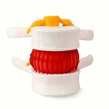 Human Anatomical Lumbar Disc Herniation Model - Lumbar Spine Model For Teaching & Learning - Excellent Way For Demonstrating Disc - White - View 3